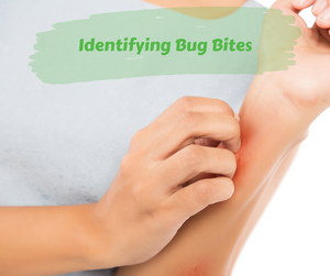 Identifying Bug Bites