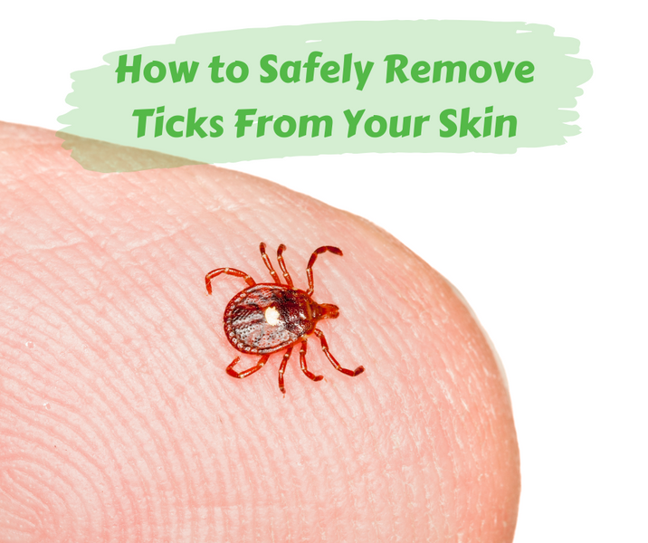 How to Safely Remove Ticks From Your Skin
